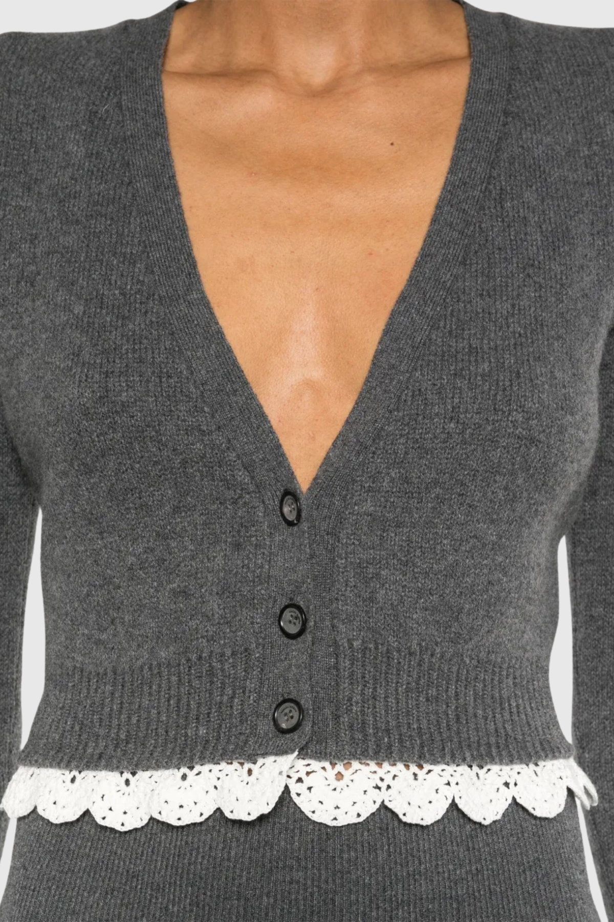 Magni Lace-trim Cardigan & Shorts Set